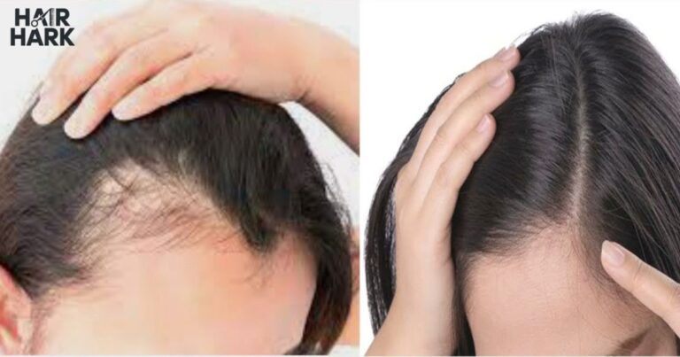 #1 Tip for Getting Past The Awkward Stage of Hair Growth