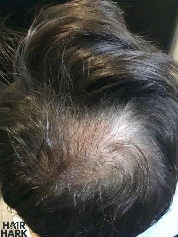 Common Mistakes That Wreck Your Results